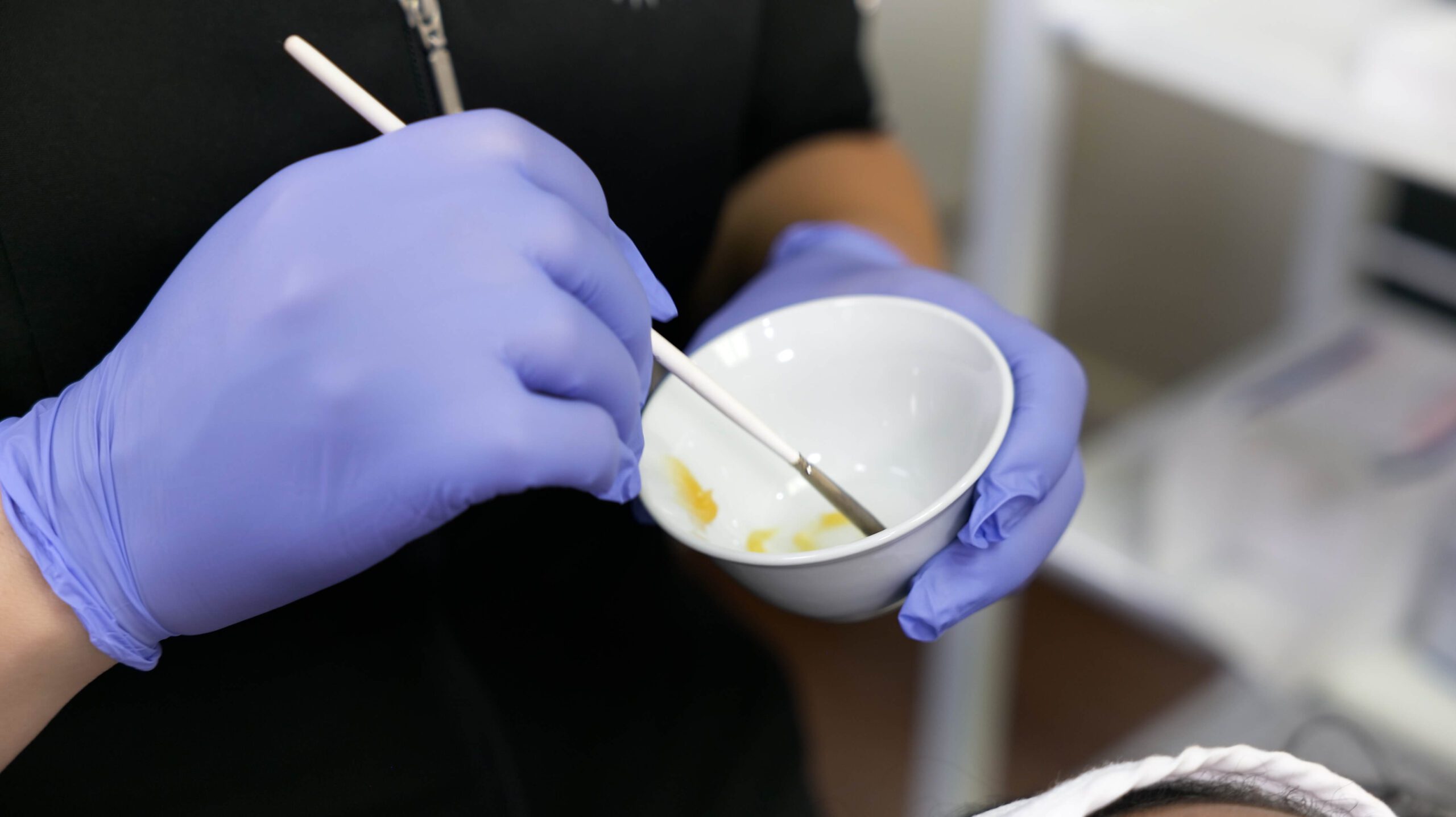 Chemical Peel Near Me