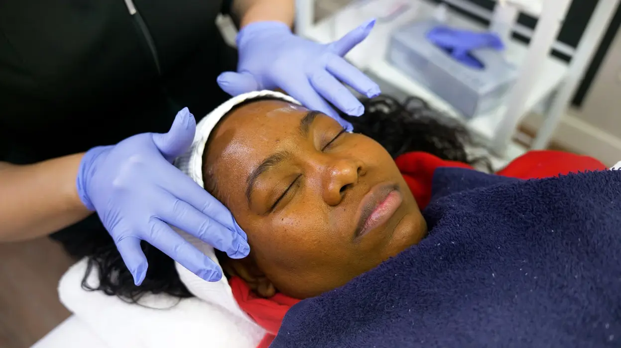 Chemical peels9 1