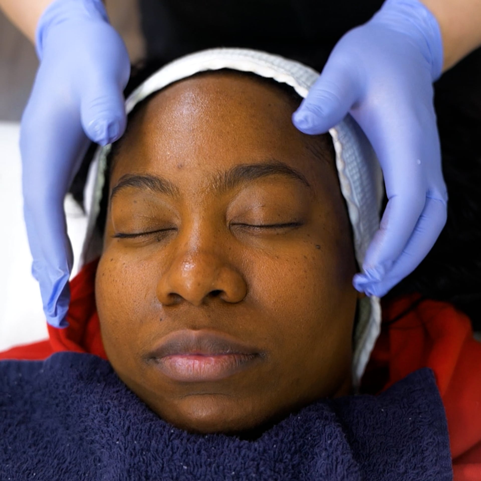 ChemicalPeel 1 mp4 image