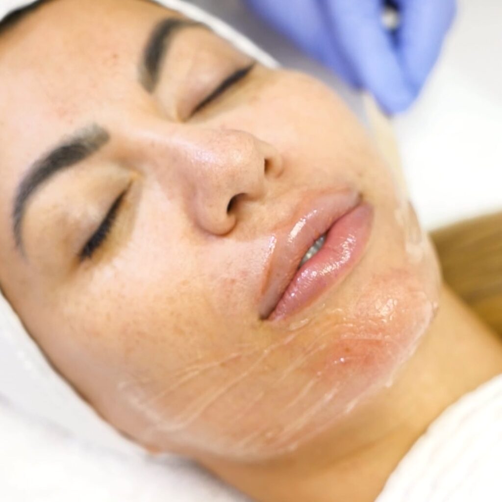 DivineTripolarRFMicroneedling mp4 image