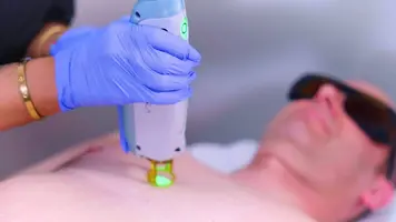 Laser Hair Removal Near Me 1536x862 1