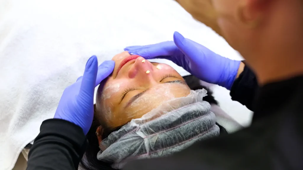 Tropicalaser Acne Treatment 04