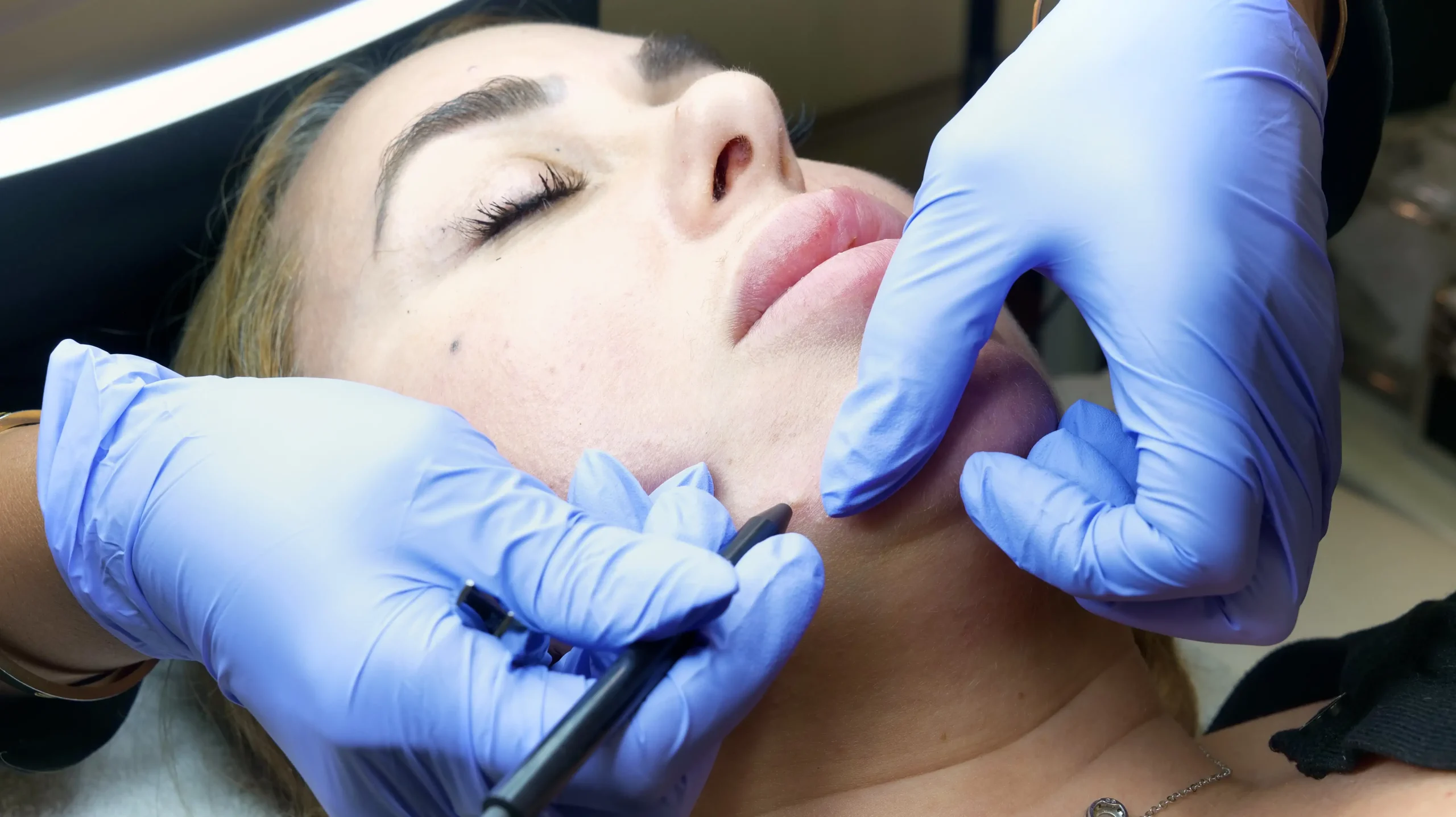 Tropicalaser Electrolysis Hair Removal 1 scaled