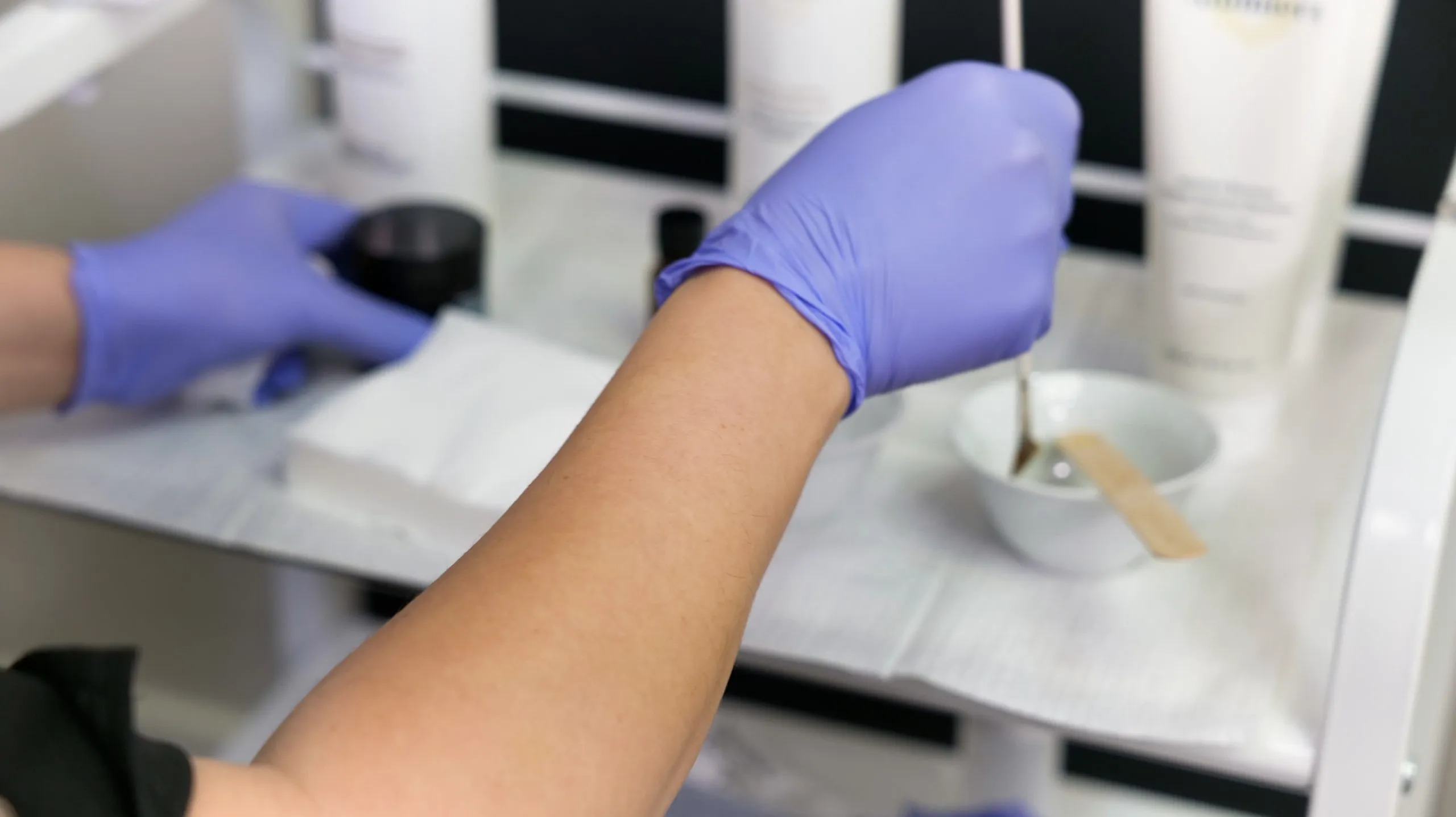 imgi 33 Chemical Peel Treatment Edmonton scaled 1
