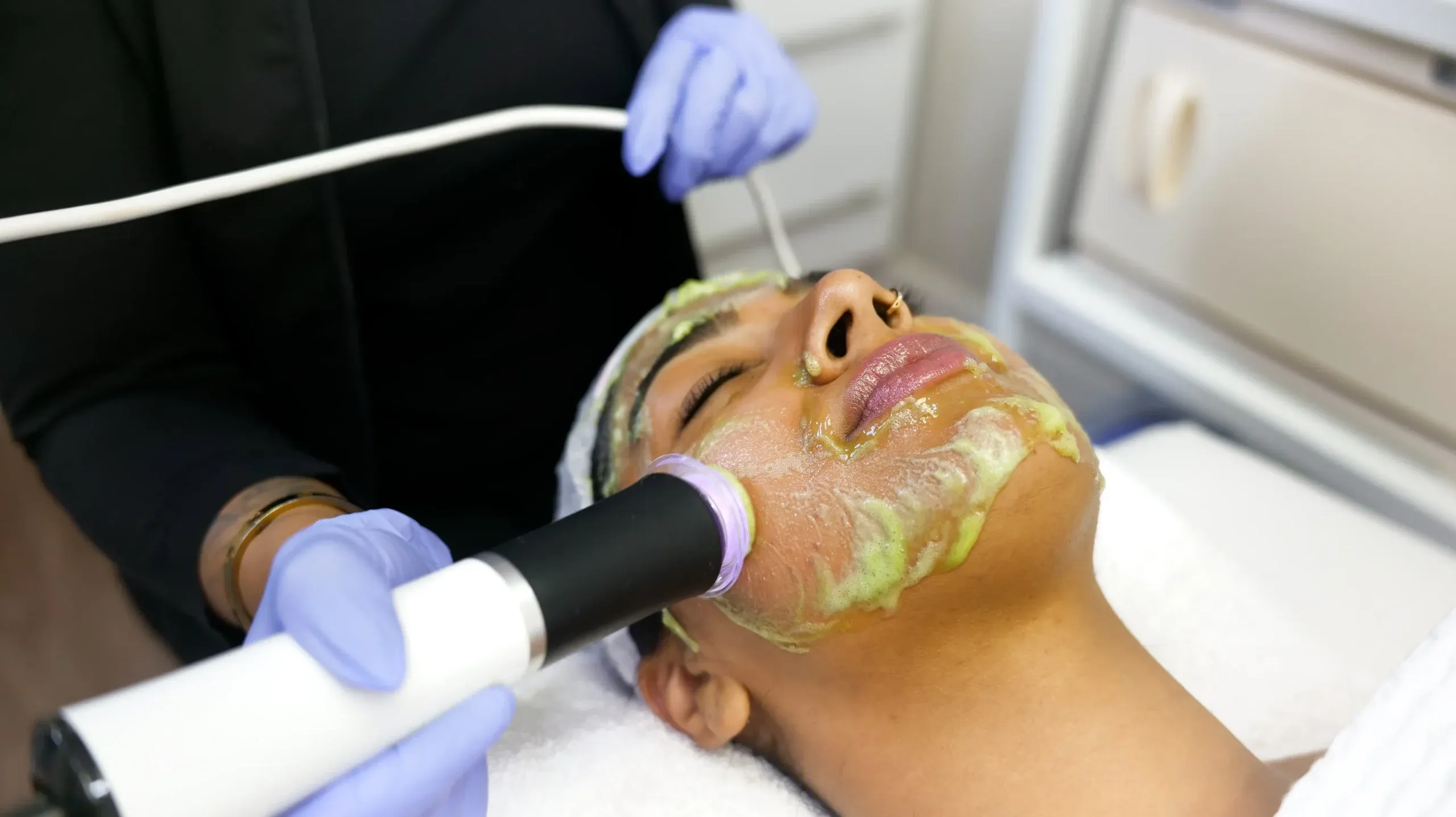 imgi 37 Tropicalaser Facials 09 scaled 1