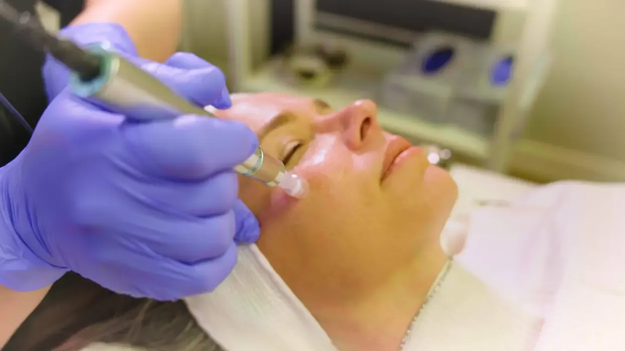 imgi 50 Microneedling.jpg scaled 1 1
